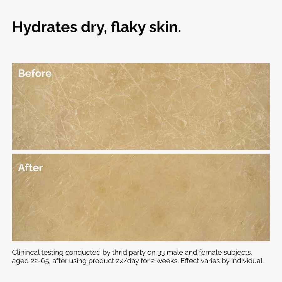 the-body-care-collection-a0 ord-natural-moisturizing-factors-inulin-body-before-after-graphic-02.jpg