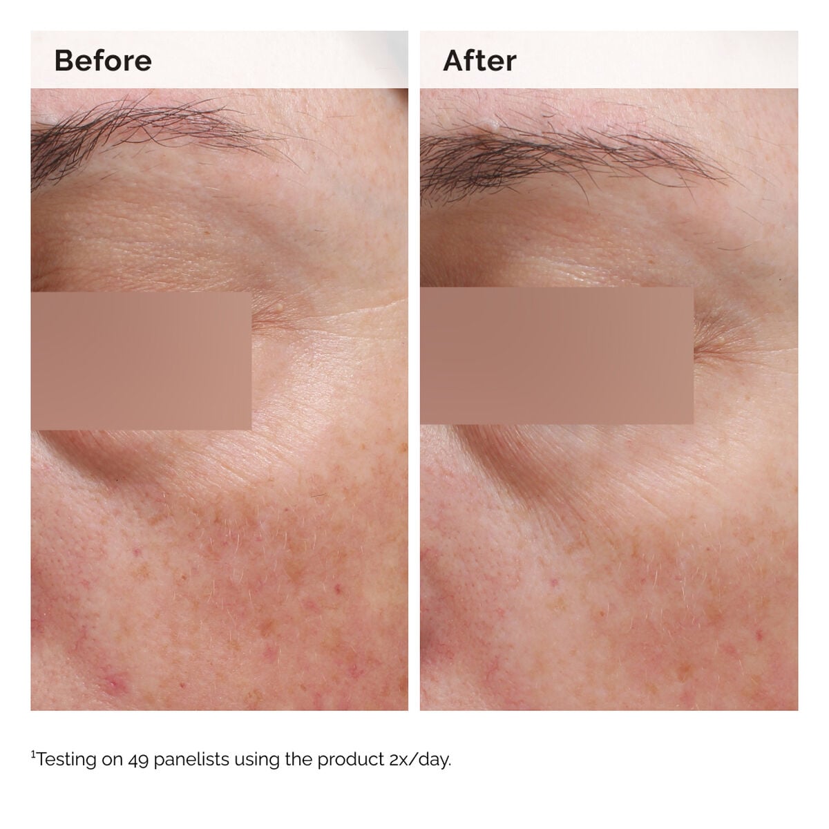 niacinamide-5-face-and-body-emulsion-e8 2024-08-23-ORD-Nia-5pct-Face-Body-B-A-Elasticity-Global-02-1x1.jpg