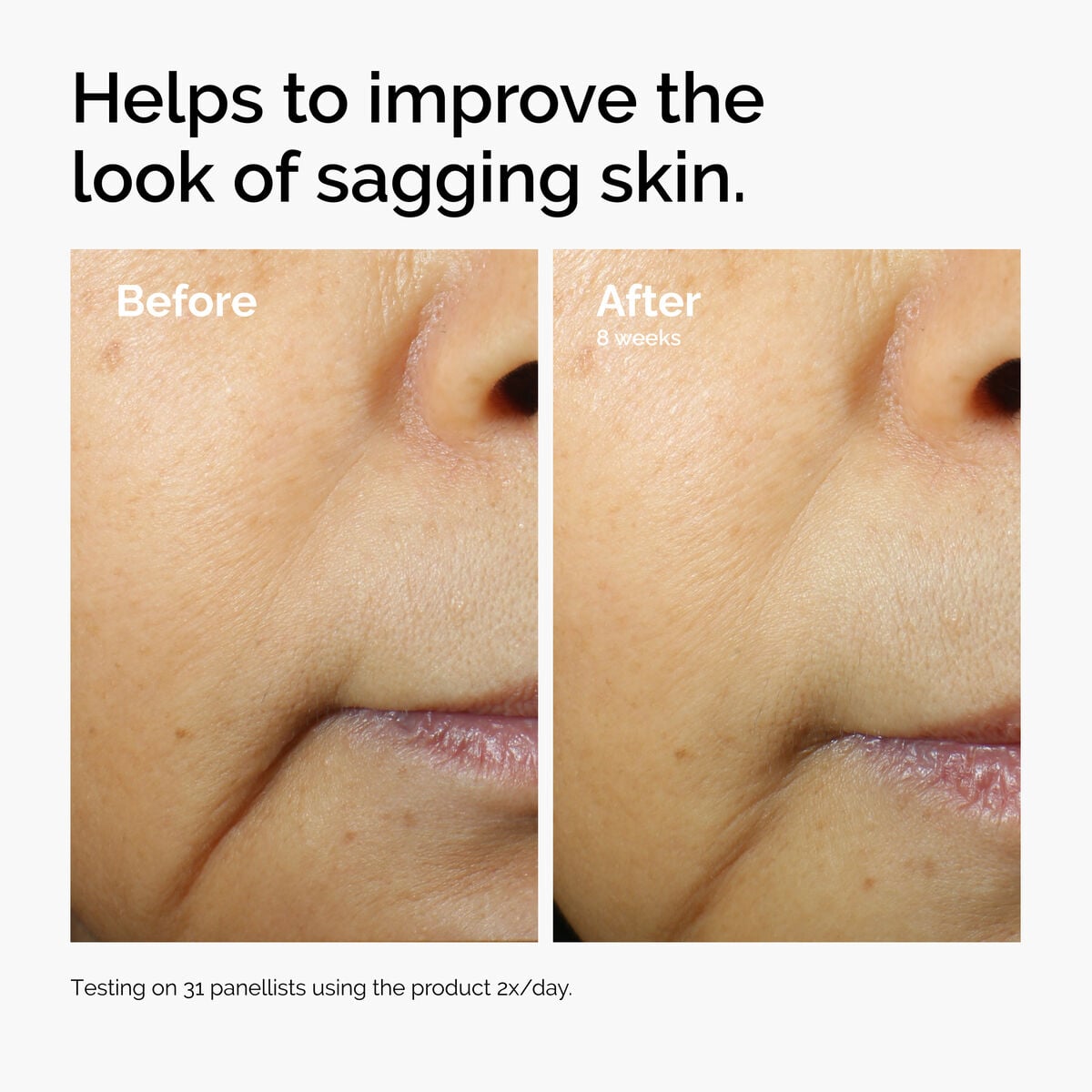 caffeine-3-escin-1-face-serum-e9 ord-caffeine-3pct-escin-1pct-face-serum-before-after-sagging.jpg