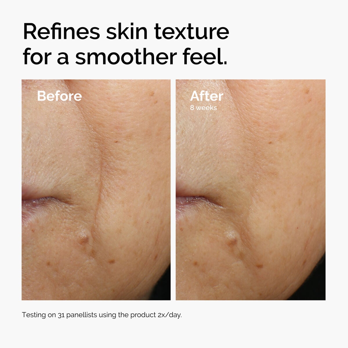 caffeine-3-escin-1-face-serum-u8 ord-caffeine-3pct-escin-1pct-face-serum-before-after-texture.jpg