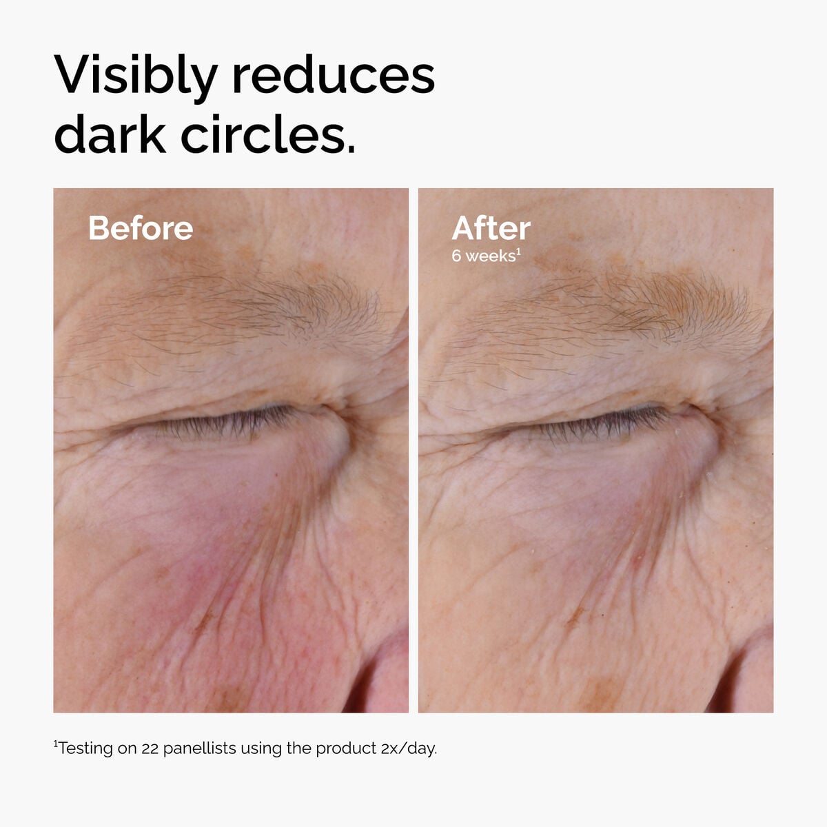 caffeine-solution-5-egcg-eye-serum-w0 ord-caffeine-solution-egcg-dark-circles-before-after.jpg