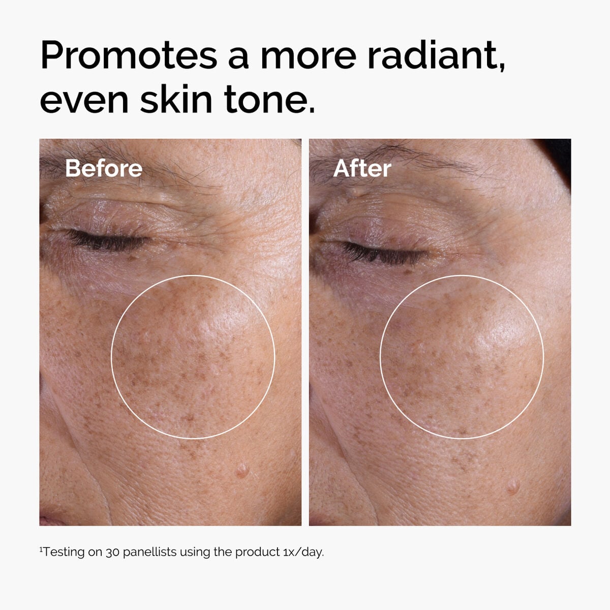 glycolic-acid-7-exfoliating-toner-z8 ord-glycolic-before-after-radiance.jpg