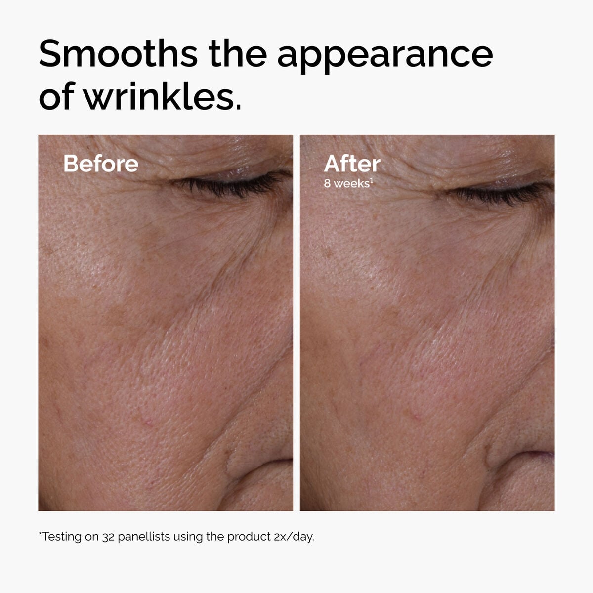 multi-peptide-ha-serum-m6 ord-multi-peptide-ha-serum-wrinkles-before-after.jpg