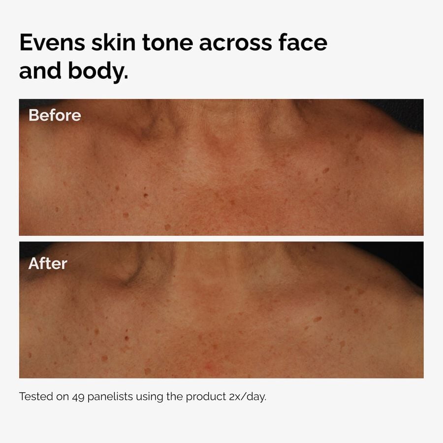 the-body-care-collection-a0 ord-niacinamide-face-body-serum-before-after-even-tone-graphic.jpg