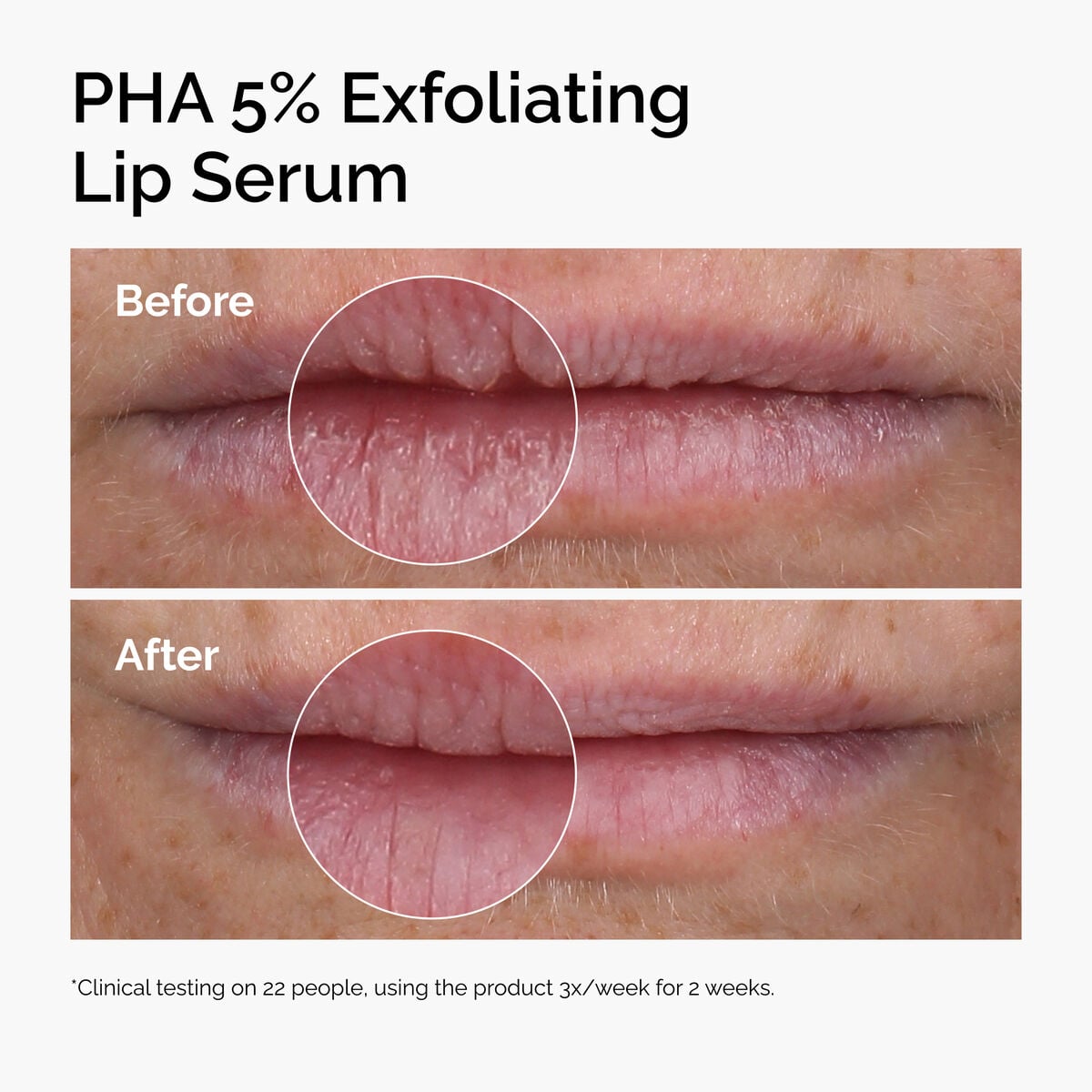 pha-5-exfoliating-lip-serum-y9 ord-pha-5pct-lip-exfoliating-serum-before-after.jpg