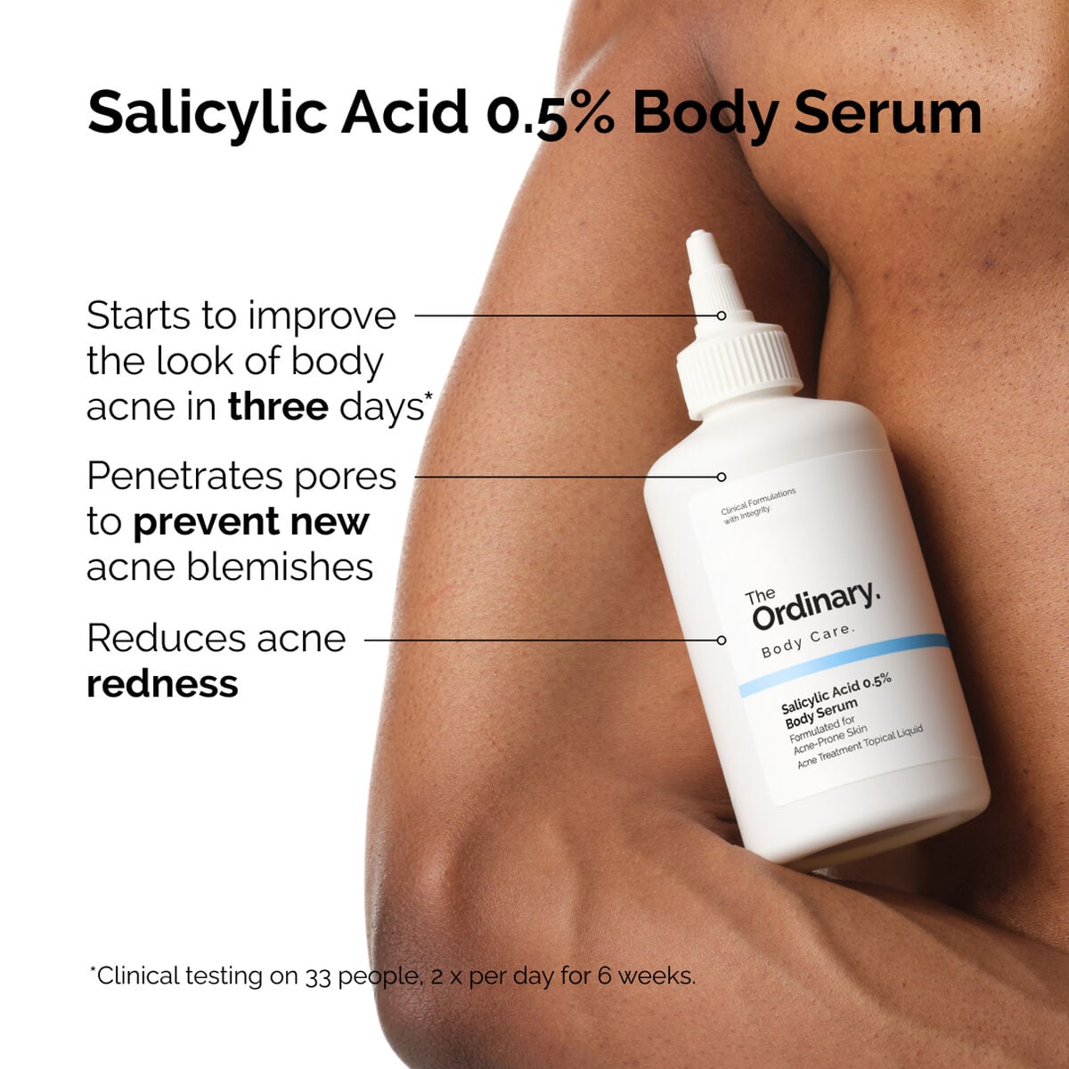 salicylic-acid-0-5-body-serum-r1 ord-salicylic-05-body-serum-otc-benefits-infographic.jpg