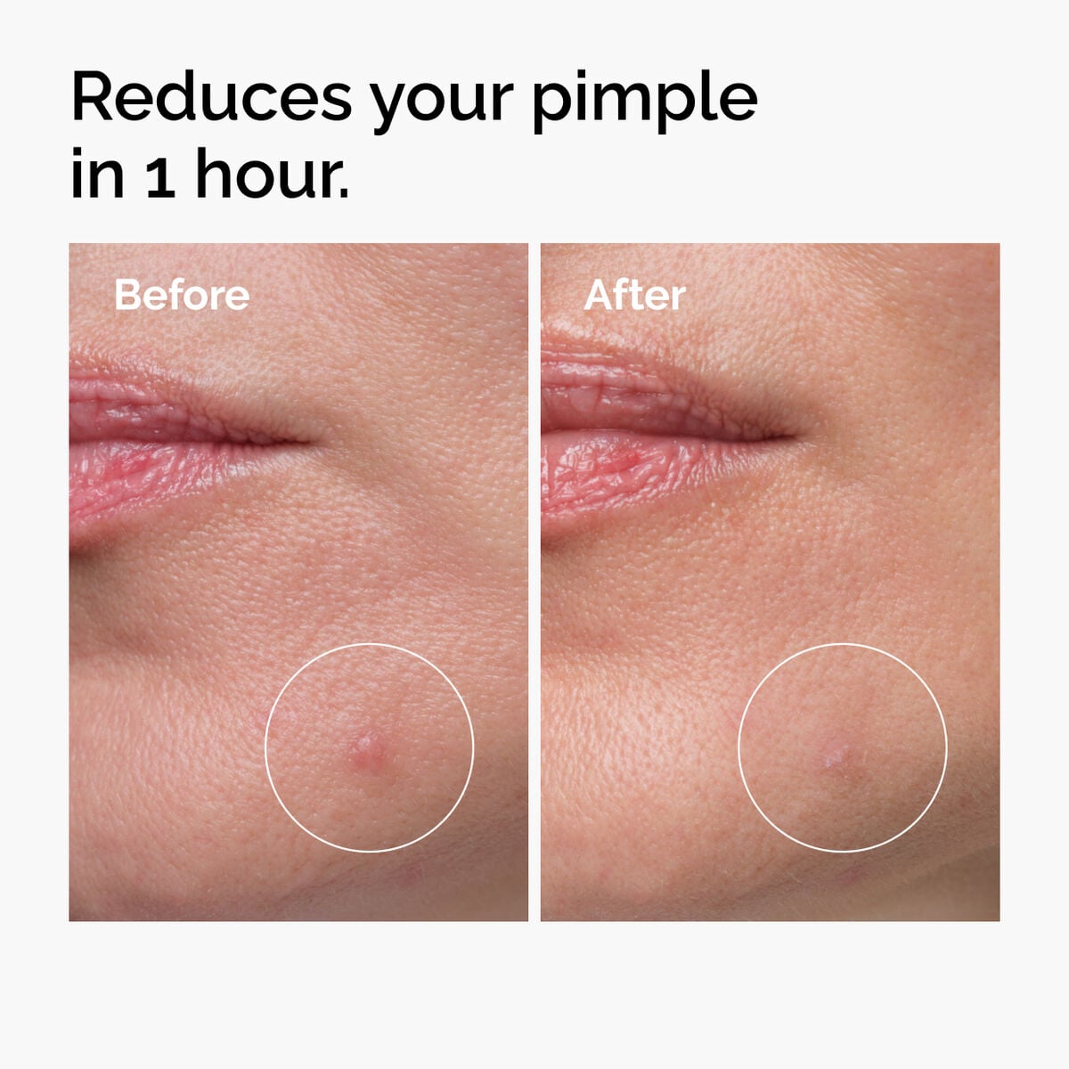 sulfur-10-powder-to-cream-concentrate-x3 ord-sulfur-10pct-powder-to-cream-concentrate-before-after-NA.jpg